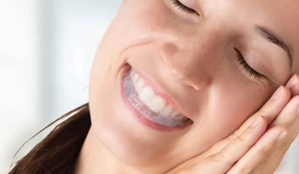 Mouthguard